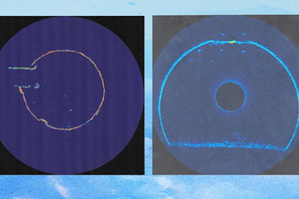 管道内部声纳检测